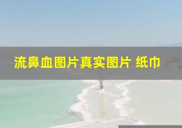 流鼻血图片真实图片 纸巾